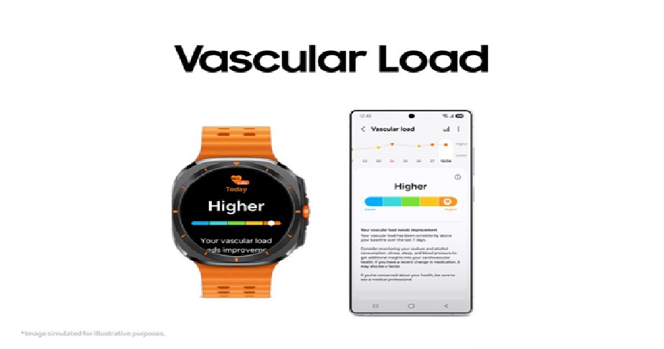 vascular load
